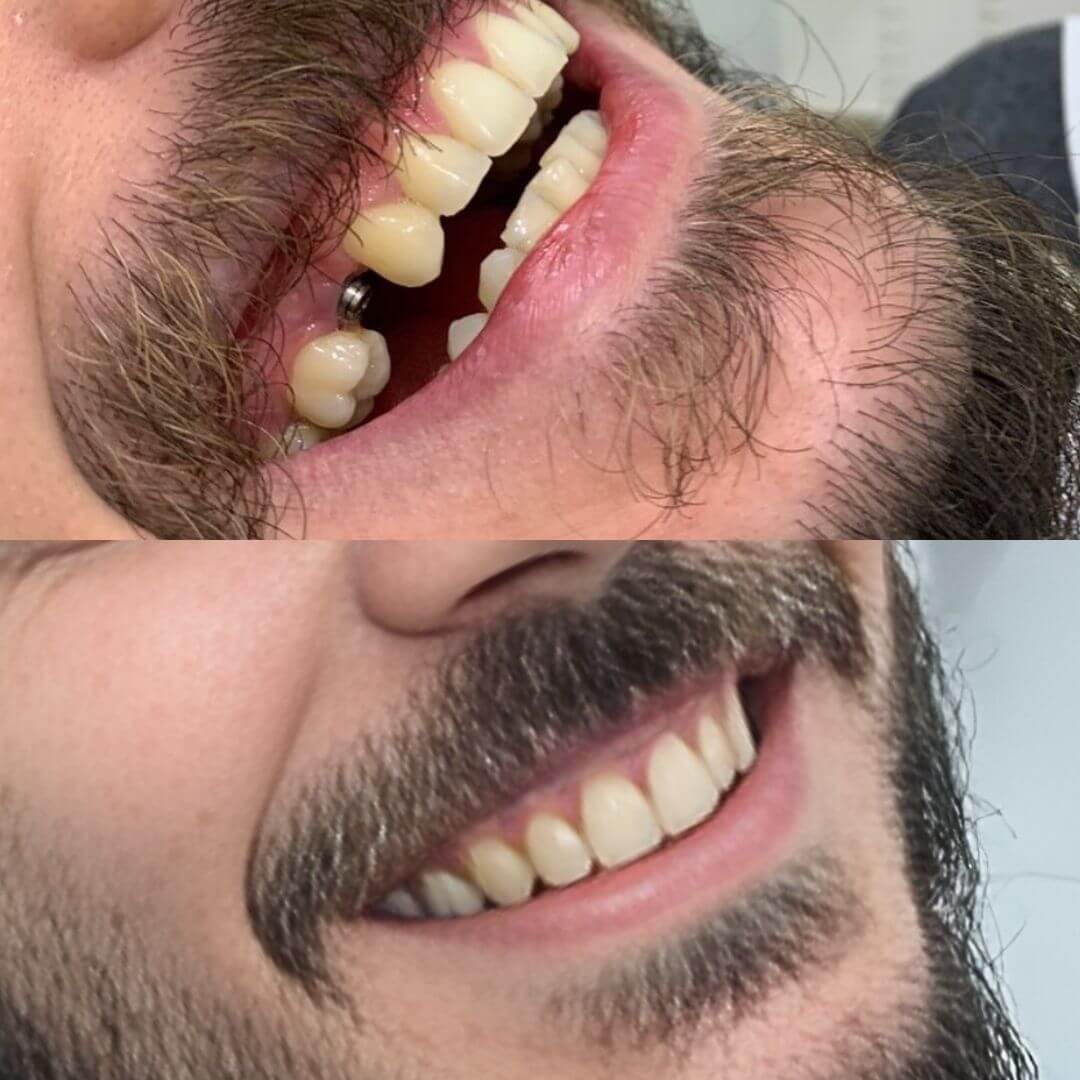 transformaçao-03