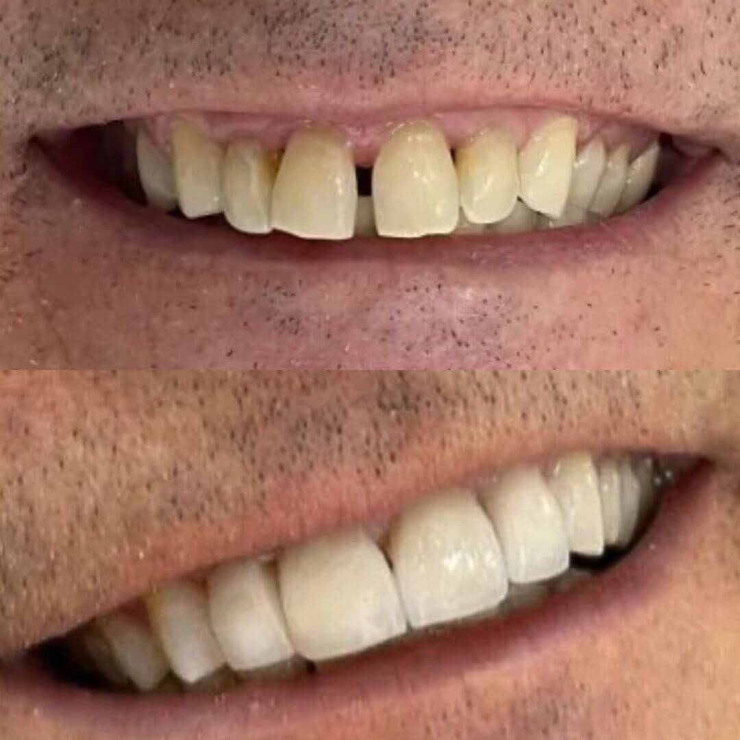 transformaçao-10