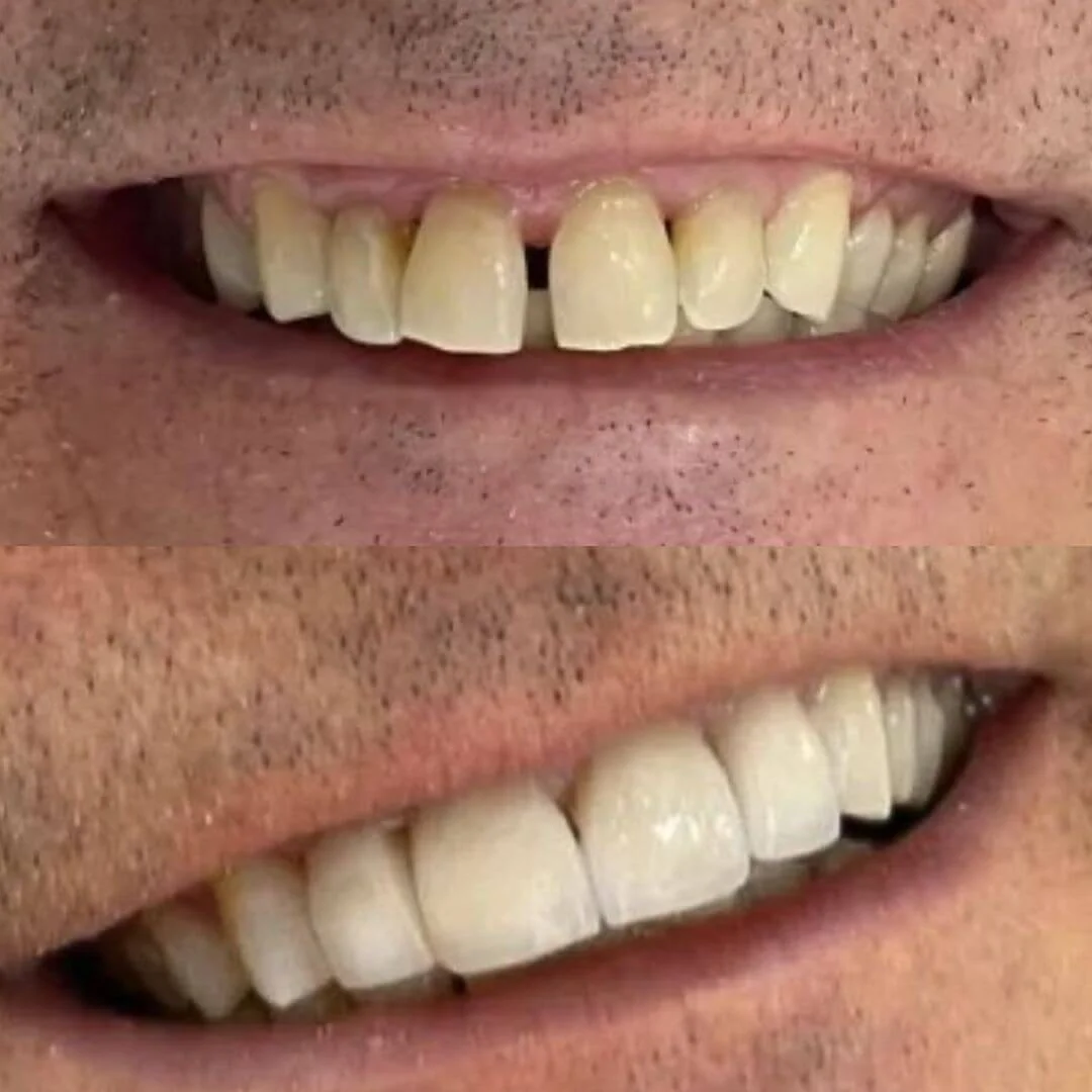 transformaçao-10