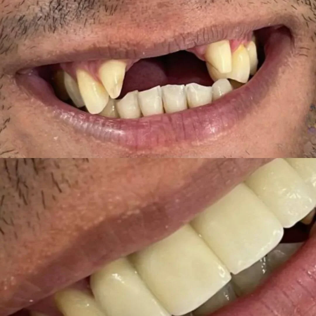 transformaçao-12