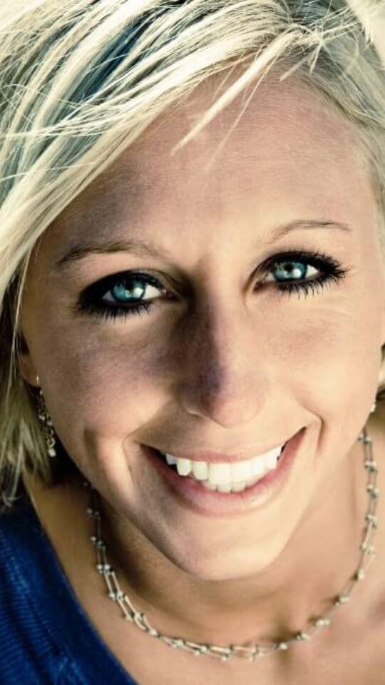 clareamento-story-02