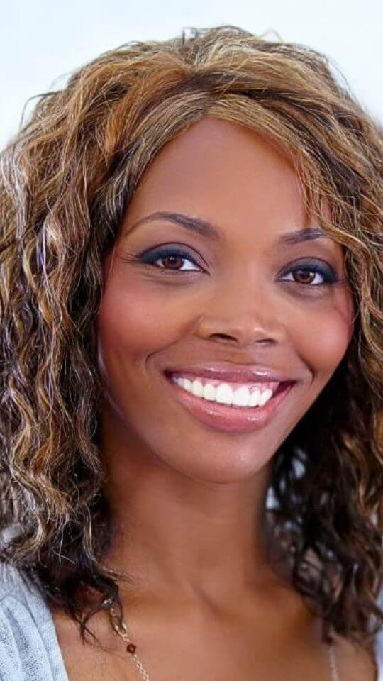 clareamento-story-04