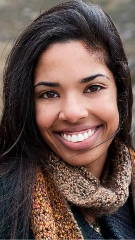 clareamento-story-05