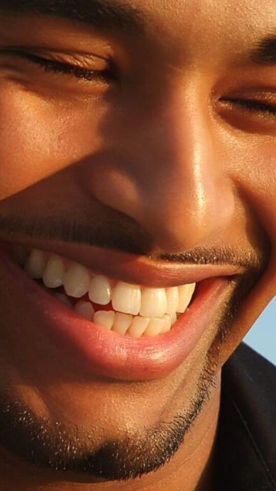 clareamento-story-06