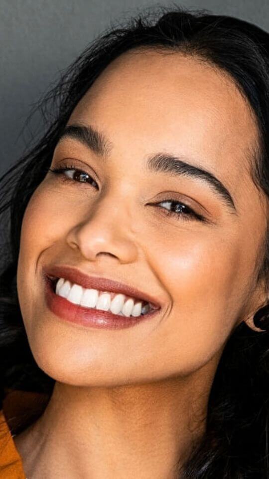 clareamento-story-07